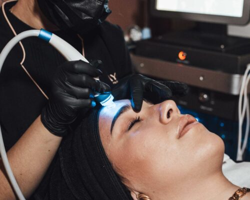 Hydrafacial: phase d'extraction