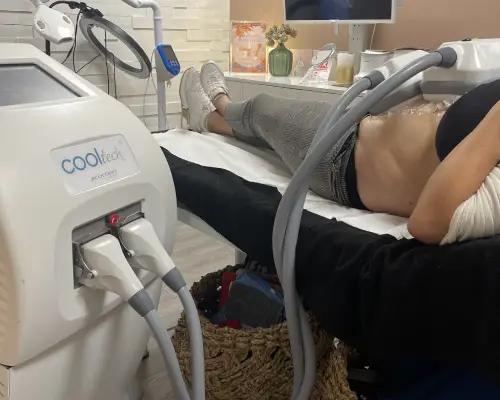 cryolipolyse machine cocoon cooltech