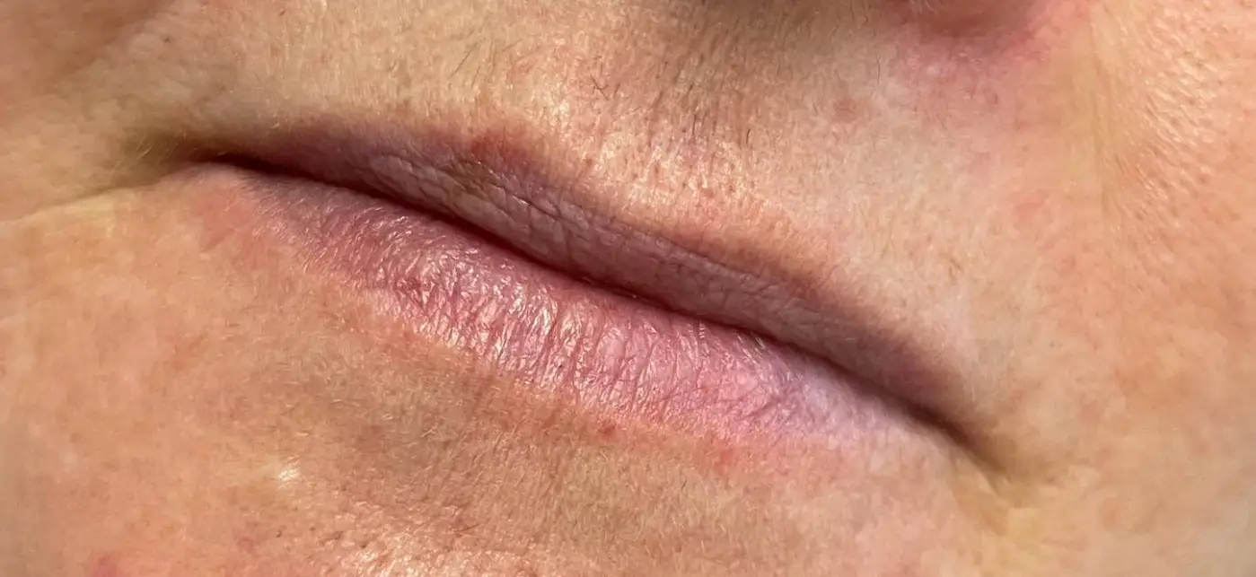 fresh lips avant-après (avant)