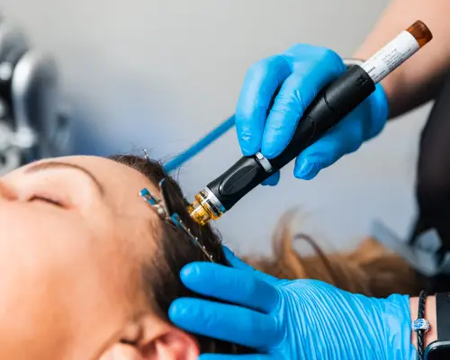 hydrafacial keravive phase d'exfoliation