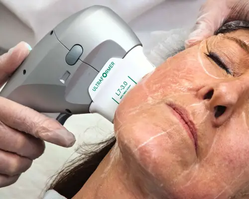 soin visage anti âge HIFU : raffermissement des tissus par onde ultrason. Stimulation de la production d'élastine et de collagène.