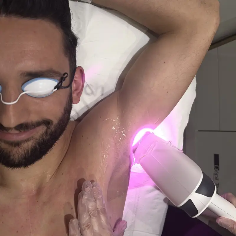 épilation laser des aisselles - institut A'Corps Beauté - Nancy et Metz