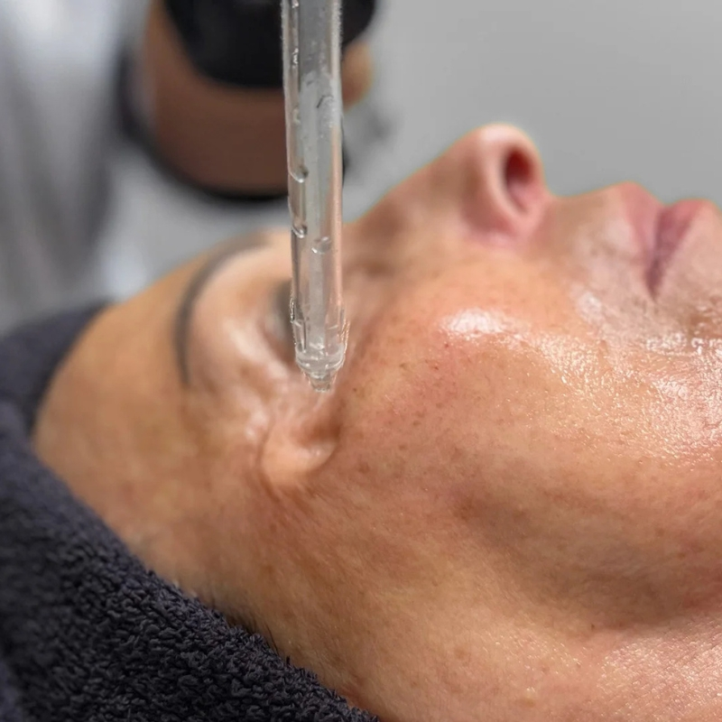 Jet Peel visage femme ACB
