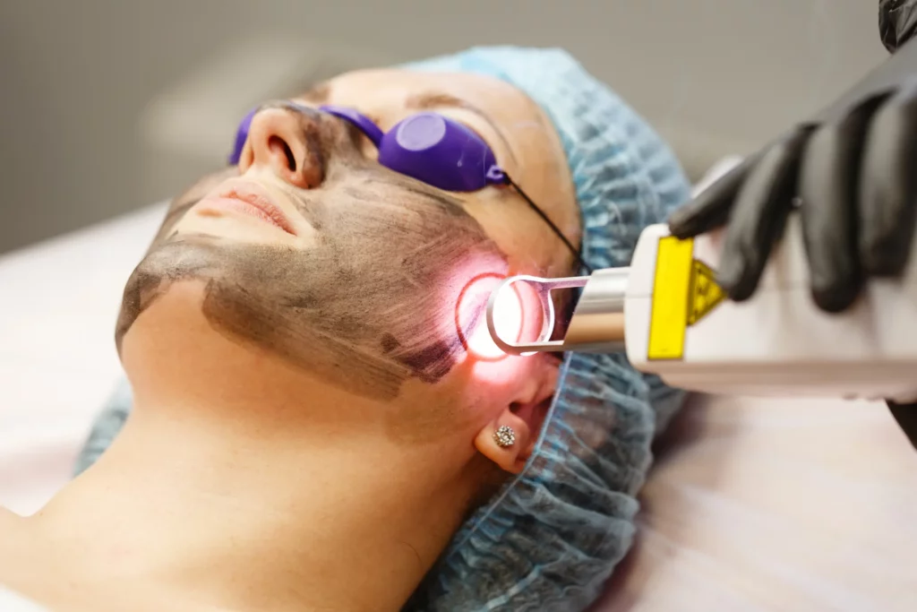 soin visage laser nd:yag