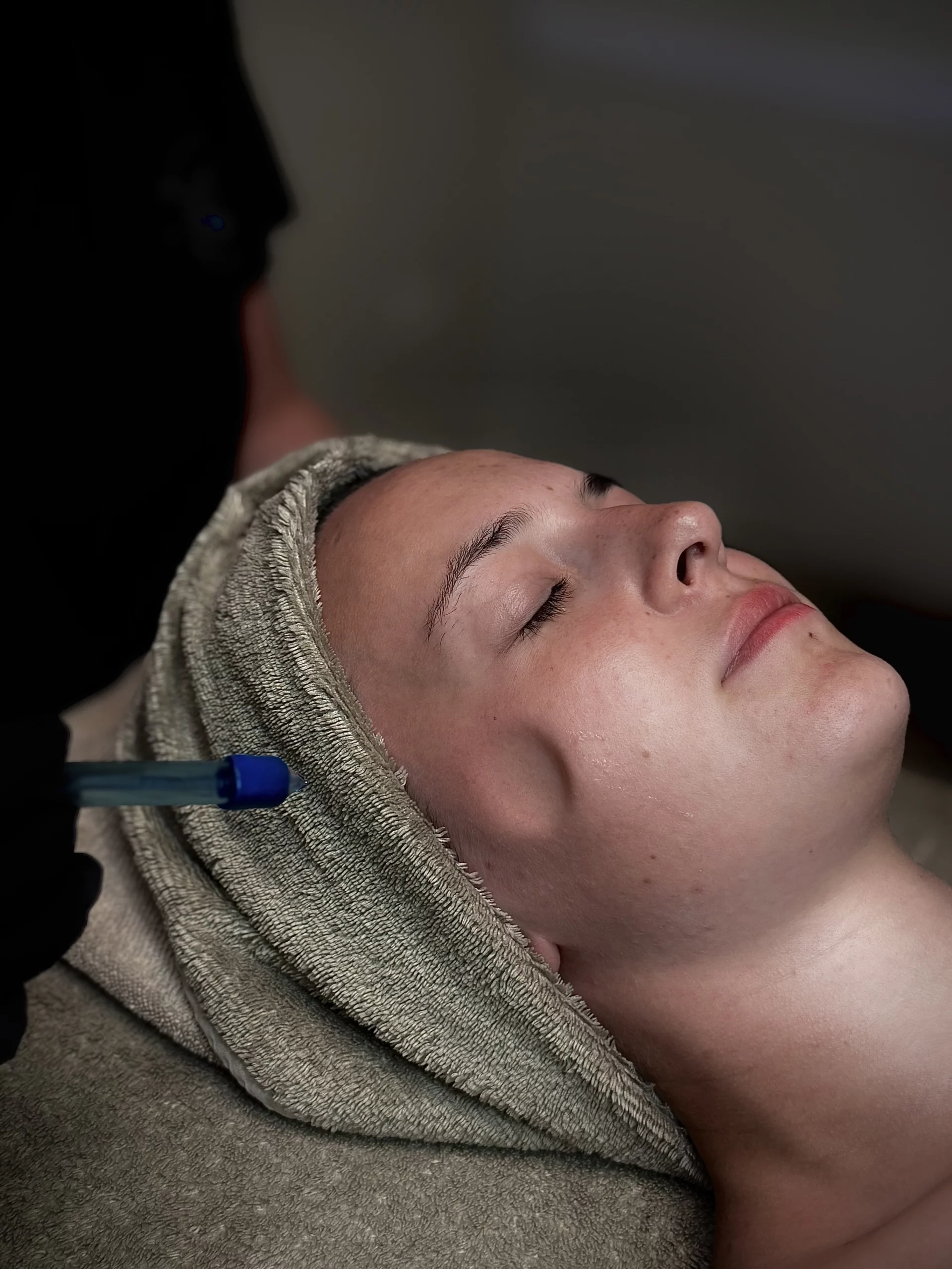 Jetpeel soin visage anti âge