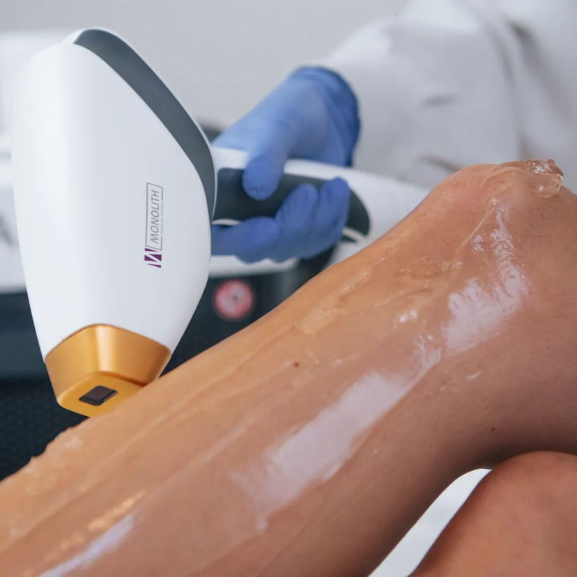 EpilationLaser_Photos15