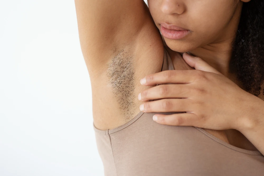 EpilationLaser_Photos3