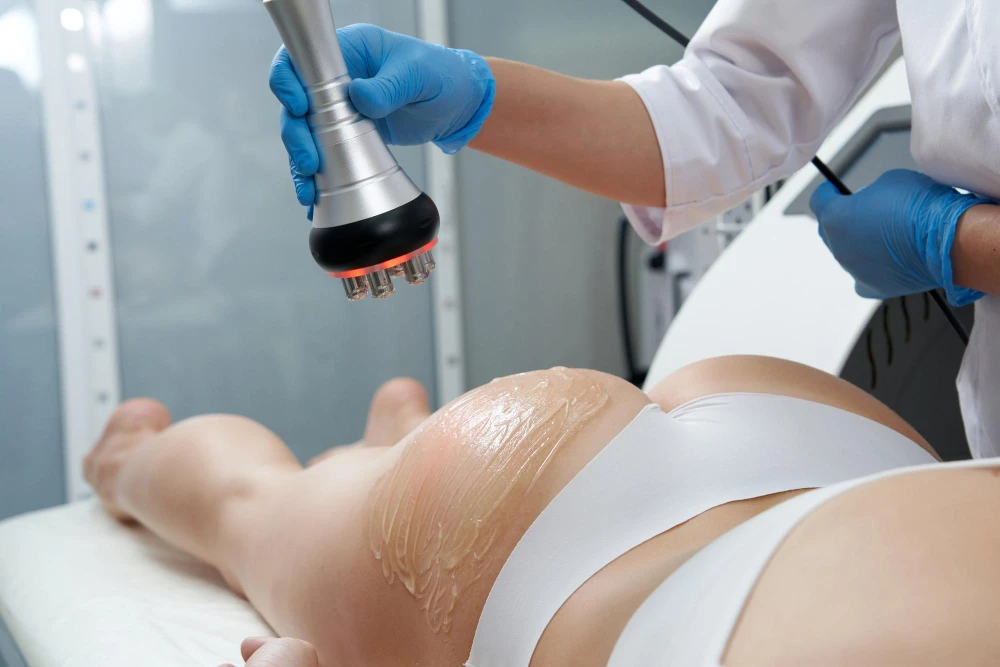 Lipocavitation1