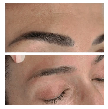 Maquillage permanent sourcils avant retrait au laser
